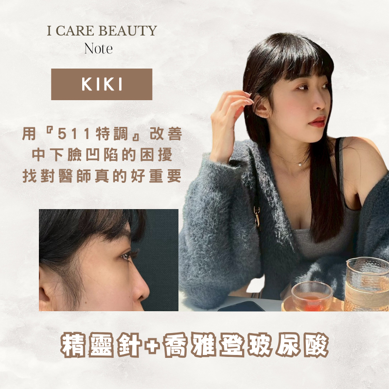 精靈針+喬雅登玻尿酸