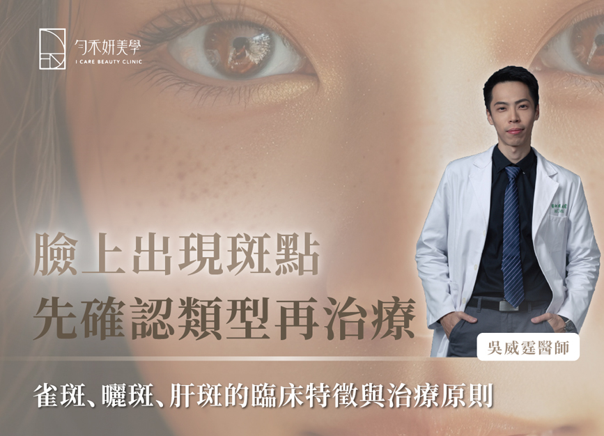 臉上長斑怎麼辦？雀斑、曬斑、肝斑的差異、成因與治療方式解析