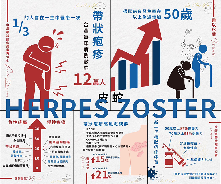 令人痛不欲生的帶狀疱疹(皮蛇)