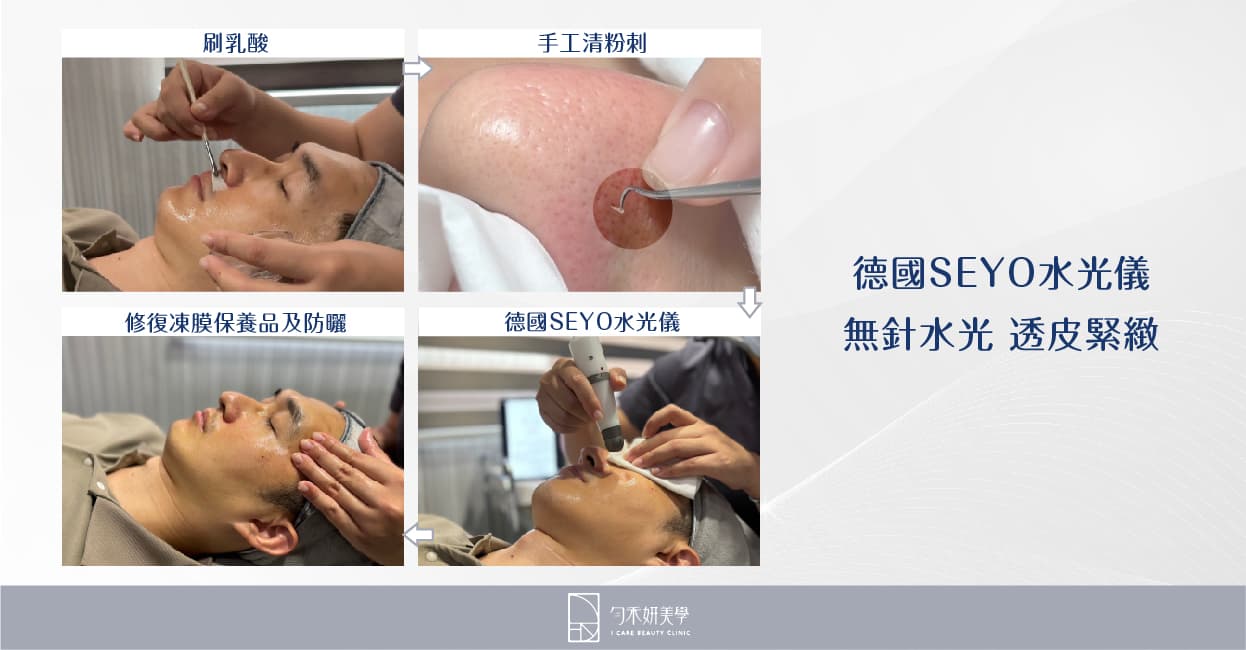 德國SEYO水光儀:無針水光、透皮緊緻 德國SEYO水光儀:無針水光、透皮緊緻