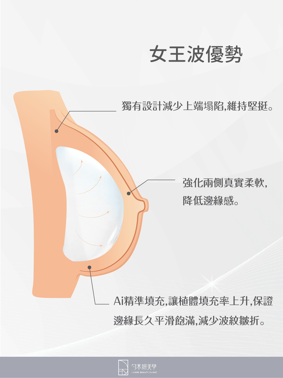 女王波優勢 女王波優勢