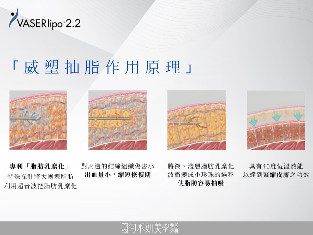 威塑抽脂作用原理 威塑抽脂作用原理