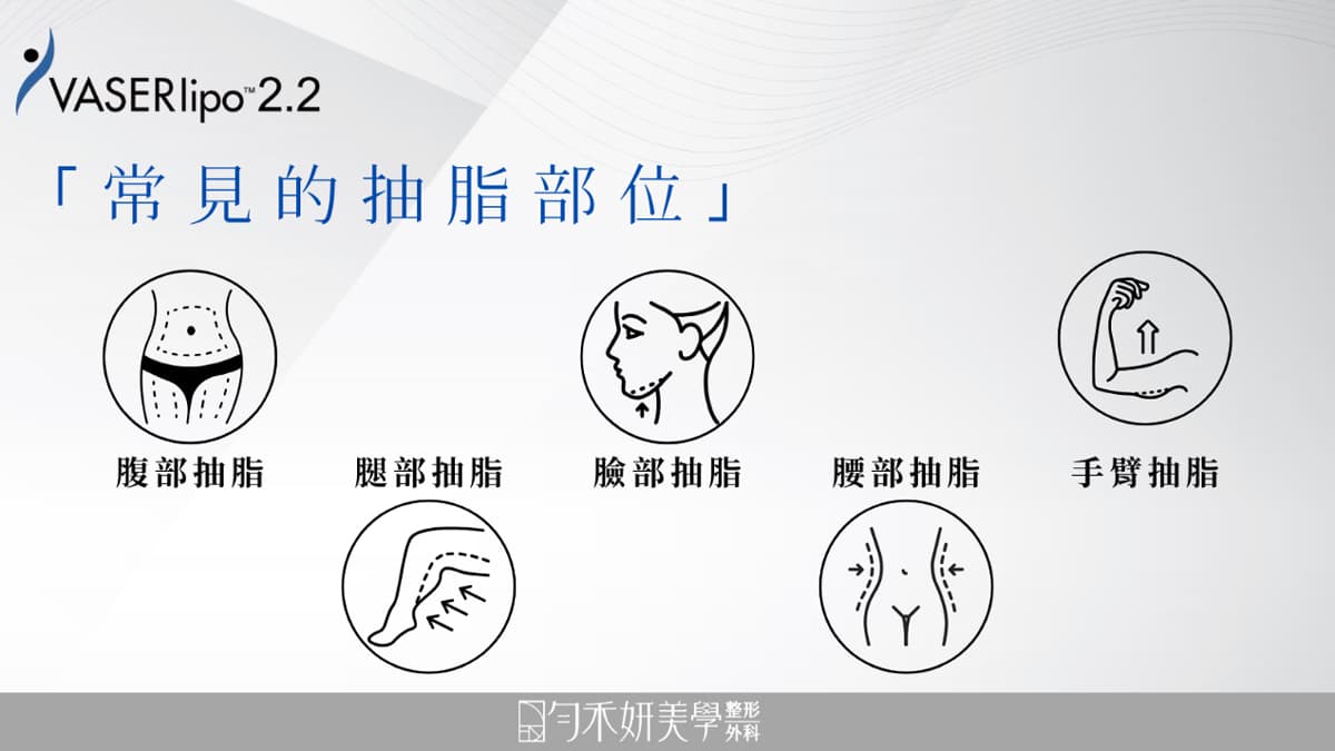 常見的抽脂部位 常見的抽脂部位