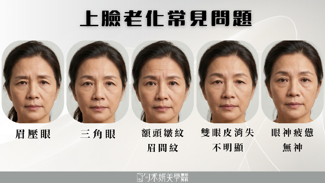 上臉老化常見問題